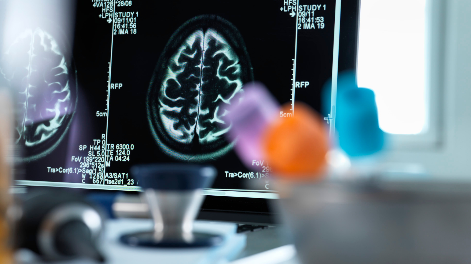 Unitat Clínica de Neuropsicologia i Neurociències